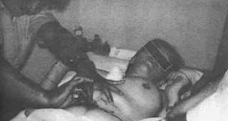 Operation ohne Narbe. Die Methoden des philippinischen Heilers sorgten im Wallis f&uuml;r heftige Diskussionen.  