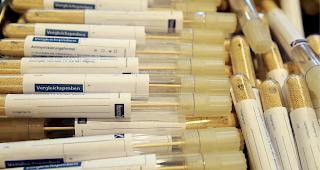 Prober&ouml;hrchen f&uuml;r einen Massentest (Symbolbild).