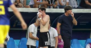 Ob Rudy am Mittwoch gegen S&uuml;dkorea wieder eingesetzt werden kann, ist noch unklar. 