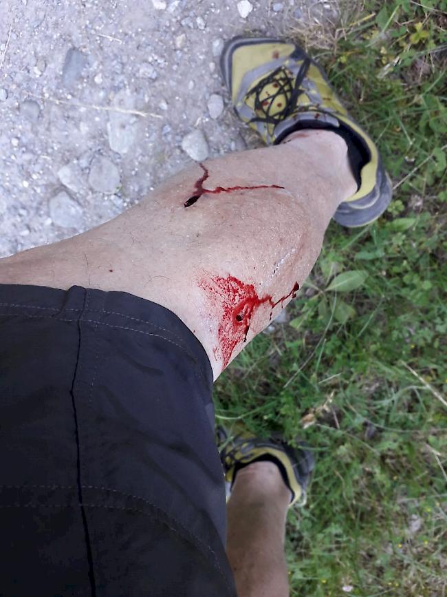 Bisswunde. Ein Schutzhund biss einen Wanderer.